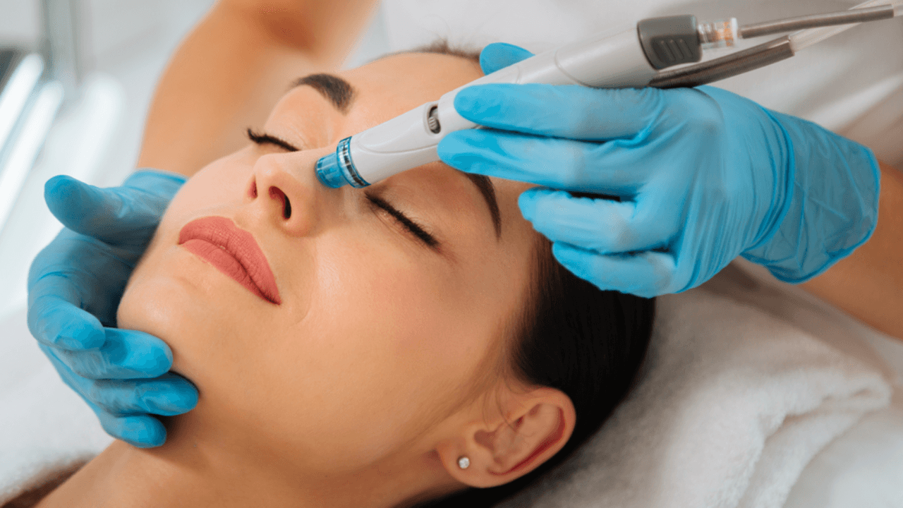 Aqua Peel (Hydrafacial)