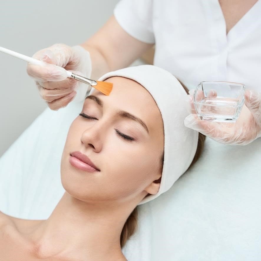 Professional Chemical Peel